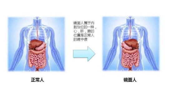 内脏器官反着长！临邑县人民医院完成一例“镜面人”PICC置管术