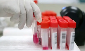 泰安市新冠病毒核酸检测价格第六次调整