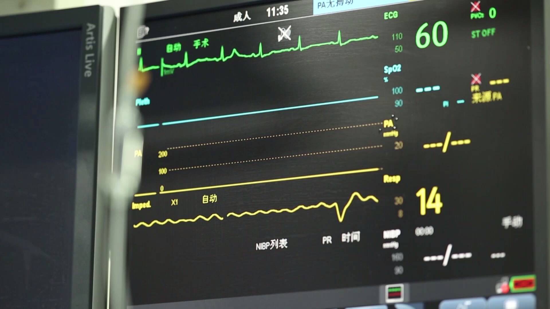 寧津村醫當前哨縣醫院做後盾心電一張網鋪就群眾健康路