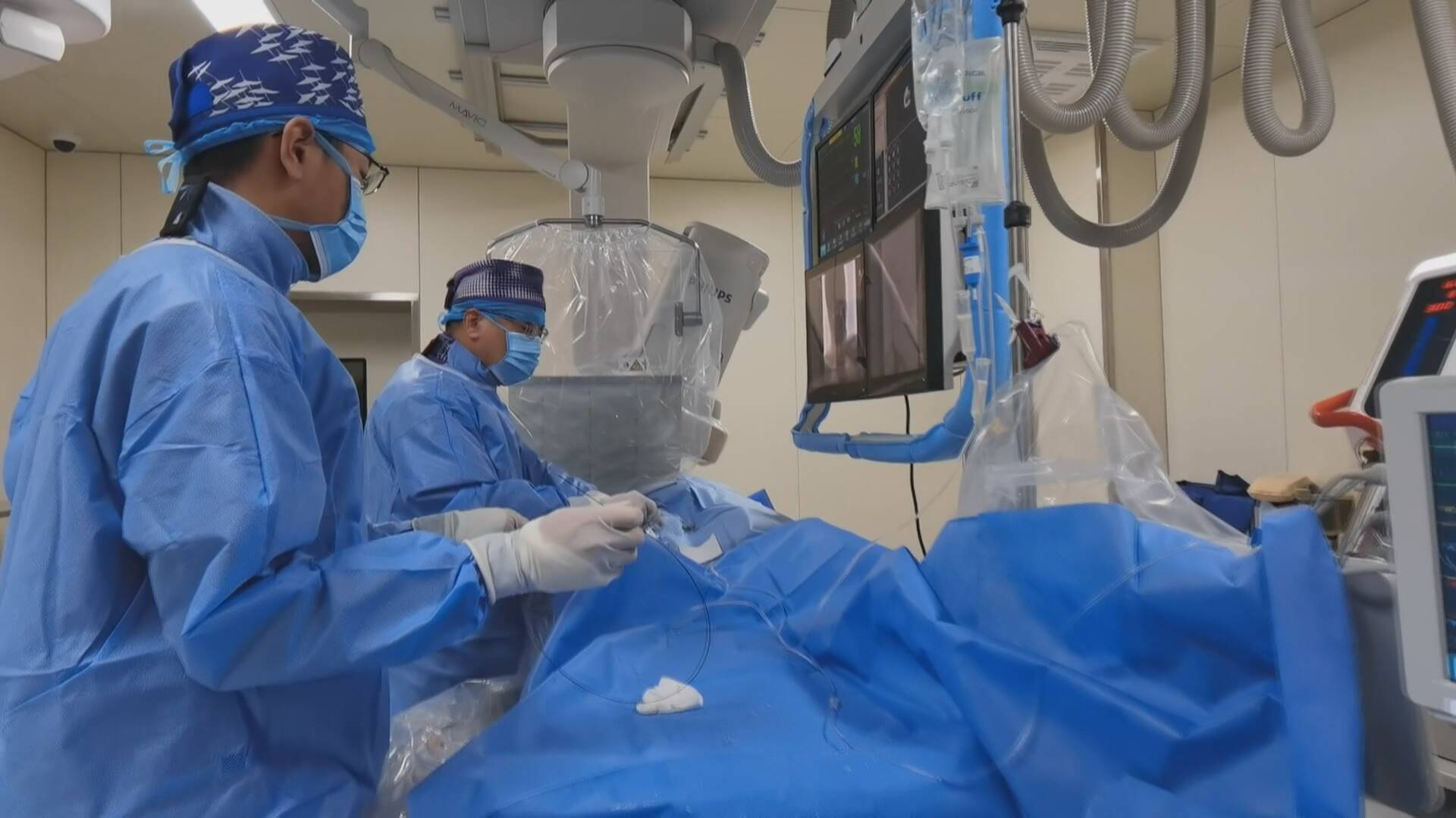 山东成武:患者突发脑梗  快速精准取栓获新生