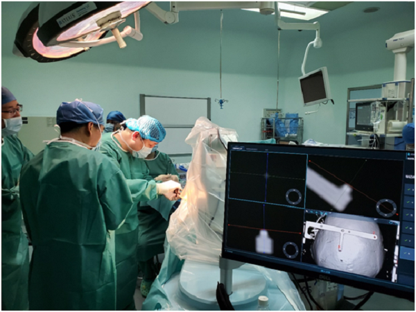 山东完成首例手术机器人辅助脑深部电刺激器植入术