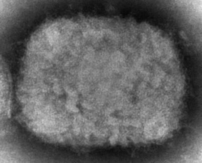 巴西猴痘确诊病例增至1860例 居全球第六