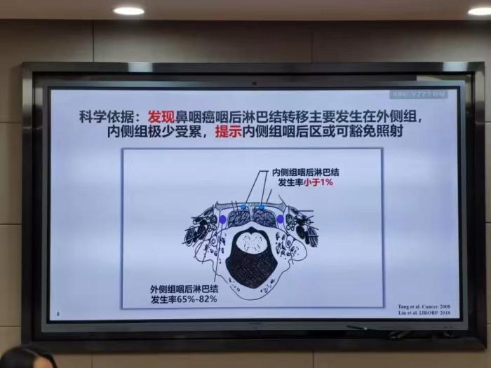 中国团队创新“减毒”技术 99%鼻咽癌患者将从中受益
