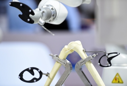 “达芬奇手术机器人”等76个新项目纳入医保
