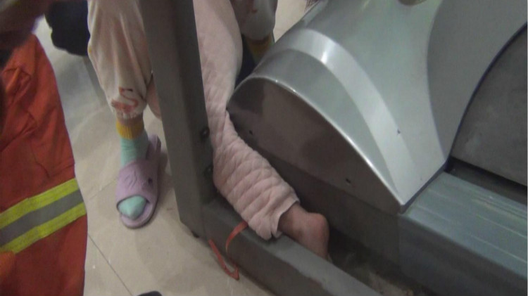 67秒丨揪心济南2岁女童跑步机上玩耍不慎摔倒左腿被卡住