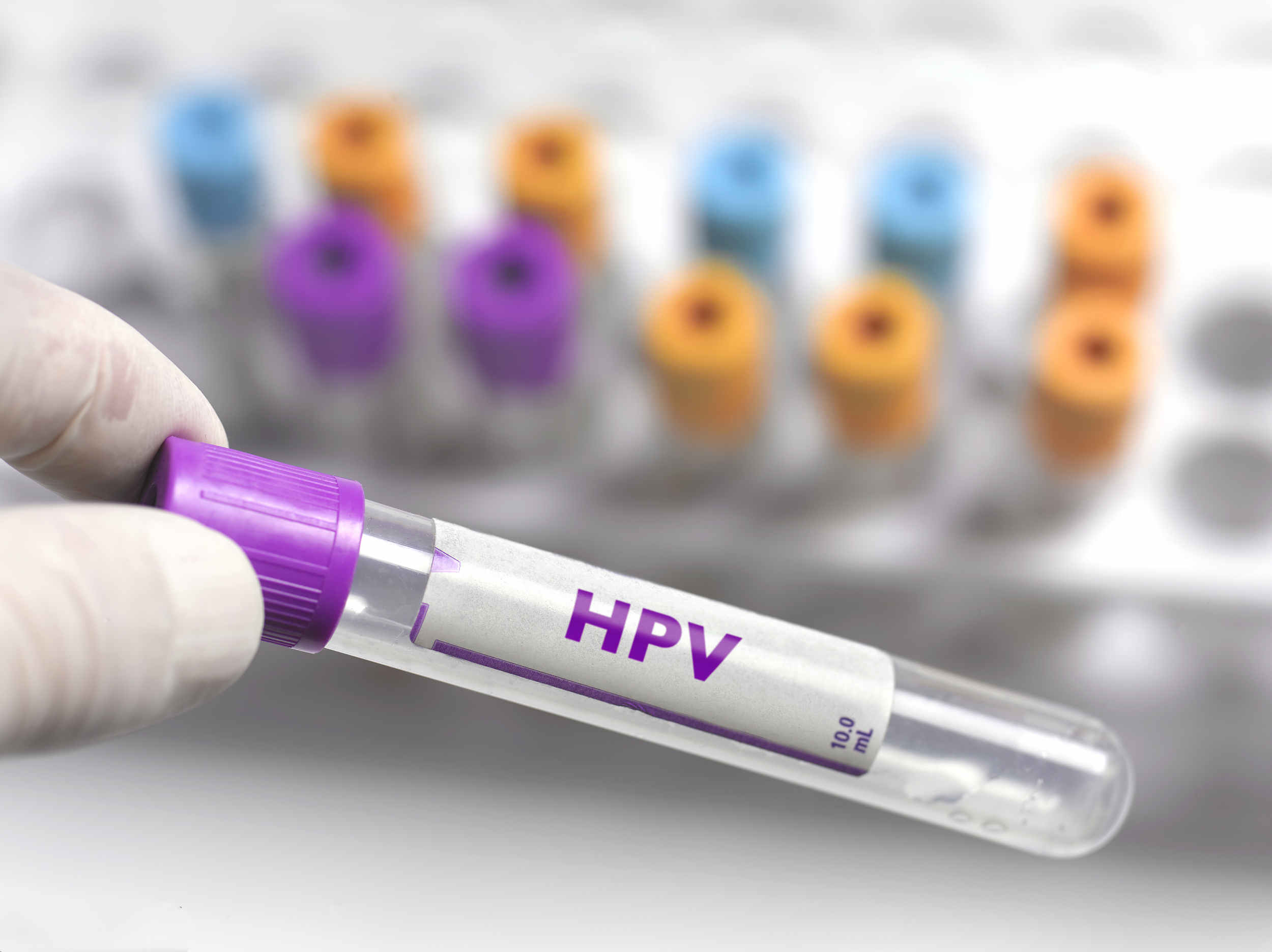 国家卫健委：重点推动条件成熟地区免费接种HPV疫苗