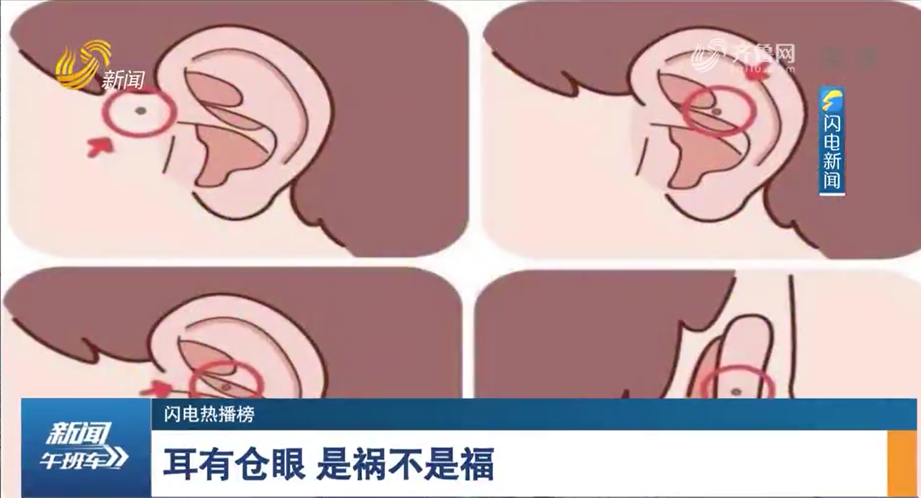 耳仓内部结构图片图片