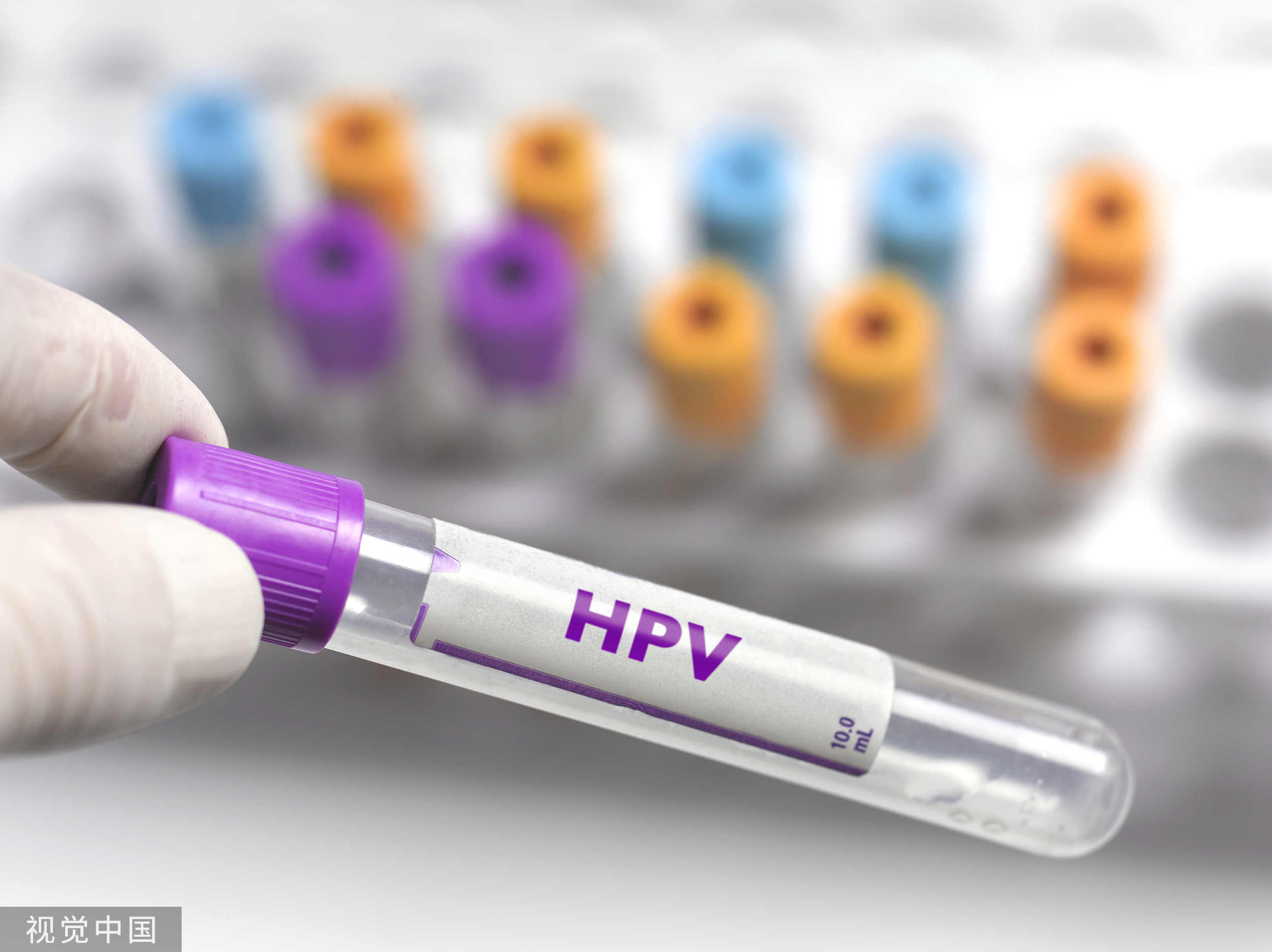 进口九价HPV疫苗国内适用人群扩大，打过四价还能再打吗？
