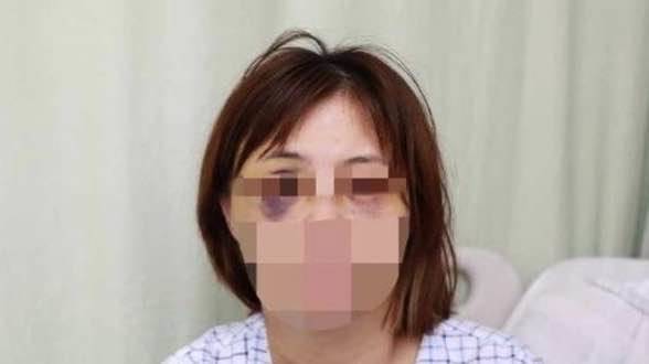 16秒丨海南一女子稱遭同居男友毆打3小時，警方介入調(diào)查