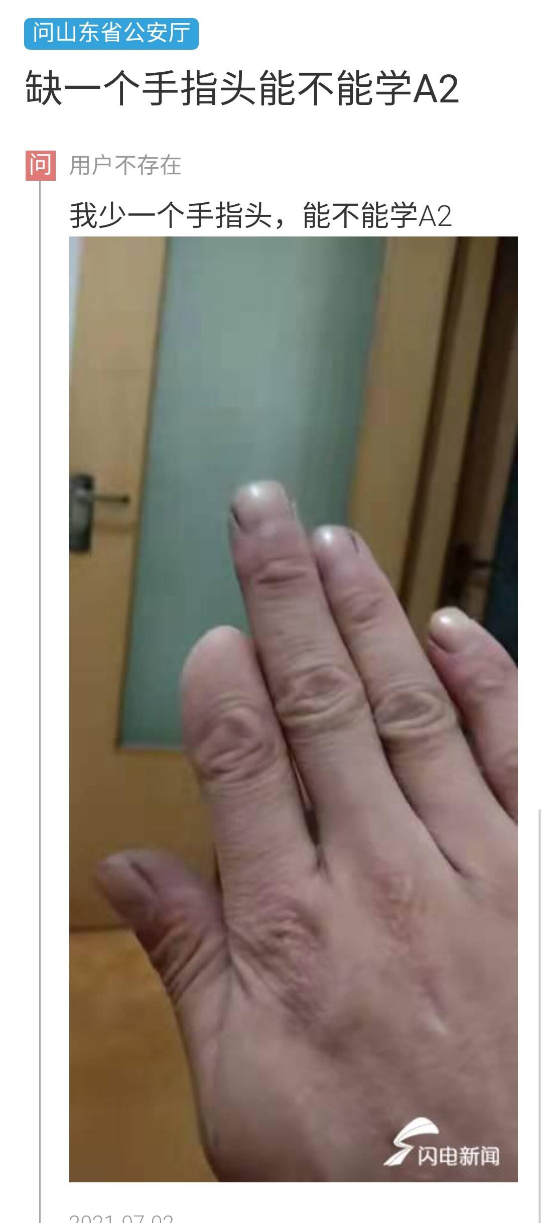驾照左手手指残缺标准图片