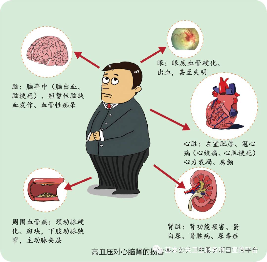 全国高血压日血压要知晓降压要达标2022年全国高血压日宣传要点