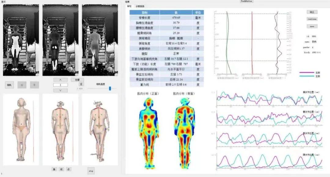 低频电刺激是什么山东省妇幼保健院：产后形体康复新利器_https://www.jmylbn.com_新闻资讯_第1张