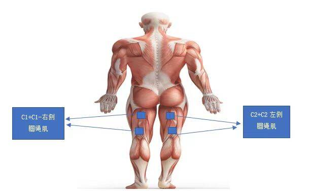 低频电刺激是什么山东省妇幼保健院：产后形体康复新利器_https://www.jmylbn.com_新闻资讯_第2张