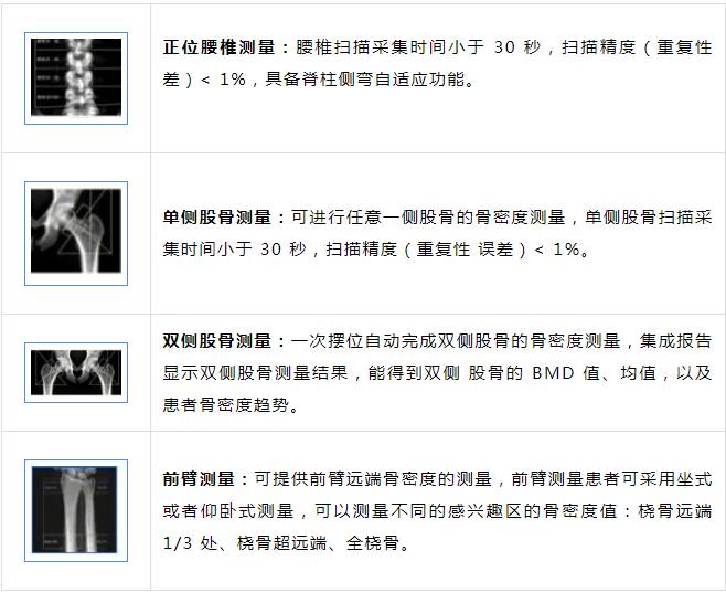 骨密度影是什么临沂市妇幼保健院医学影像科骨密度检查再添新利器_https://www.jmylbn.com_新闻资讯_第2张