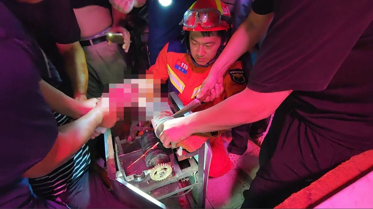 济南：女子右手不慎卷入绞肉机 消防破拆机器救援