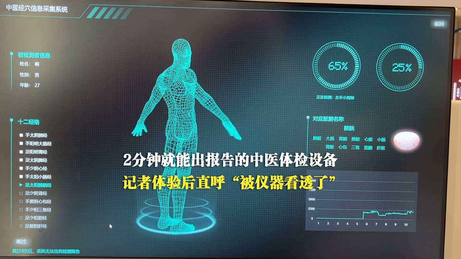 中醫體檢設備2分鐘就能出報告 記者體驗后直呼“被儀器看透了”