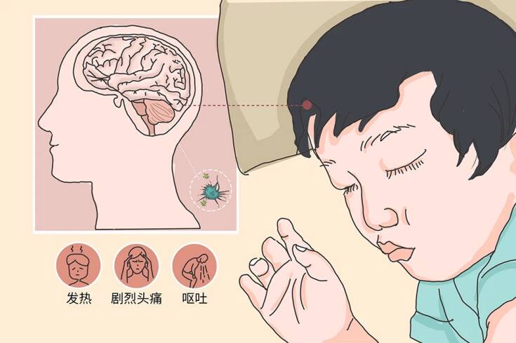 关于脑炎，你知道多少？