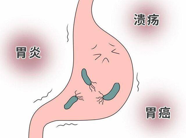 胃黏膜損傷竟是胃癌發生第一步？保護胃黏膜要吃五種食物