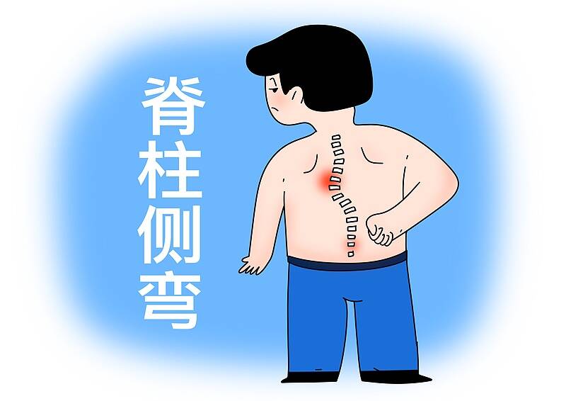 防治儿童青少年脊柱侧弯 中医有哪些独特优势