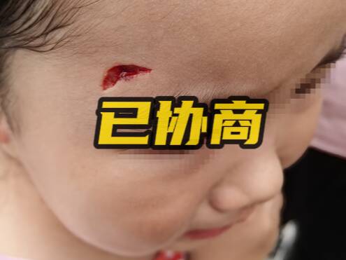 網絡問政·辦實事 | 游客被動物園孔雀啄傷 留言后雙方已協商解決