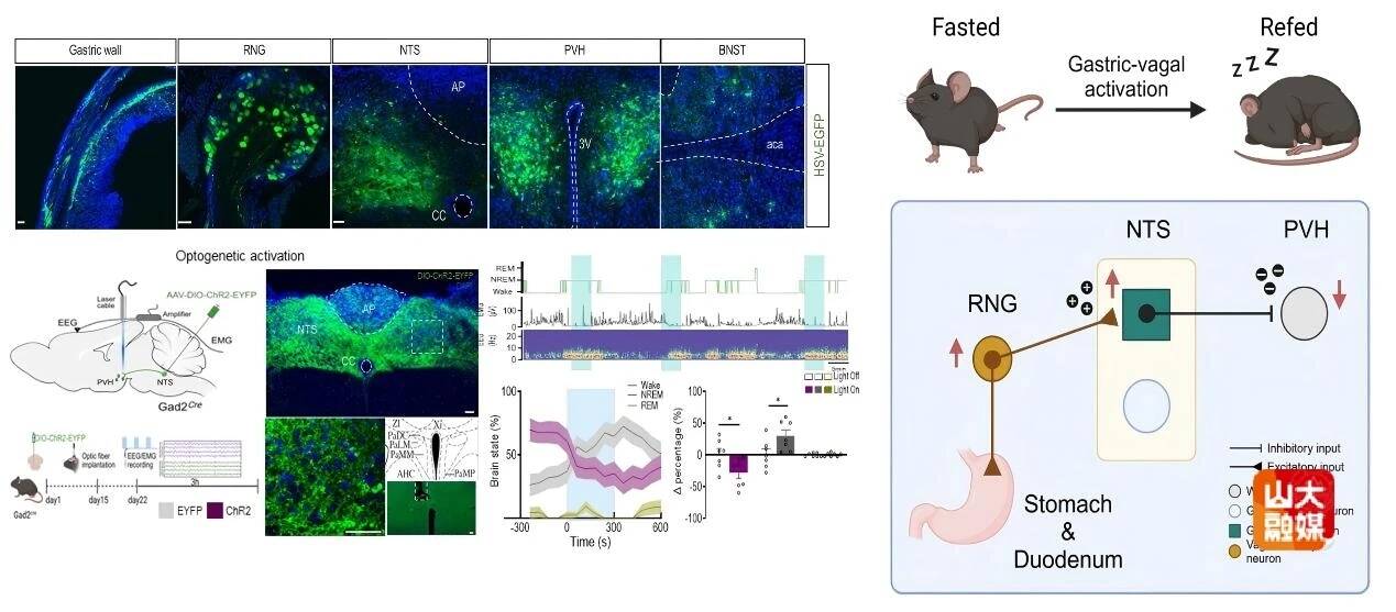 山东大学科研团队揭示“食困”成因——消化道迷走神经调控睡眠的新功能及神经环路机制
