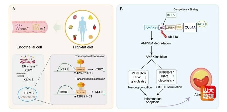 山东大学齐鲁医院全国重点实验室心血管临床和基础研究取得新成果