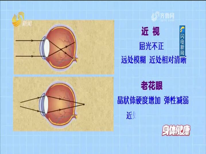 跟白内障说再见 晚年“视界”超精彩