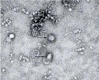 首株新型冠状病毒毒种信息及其电镜照片公布